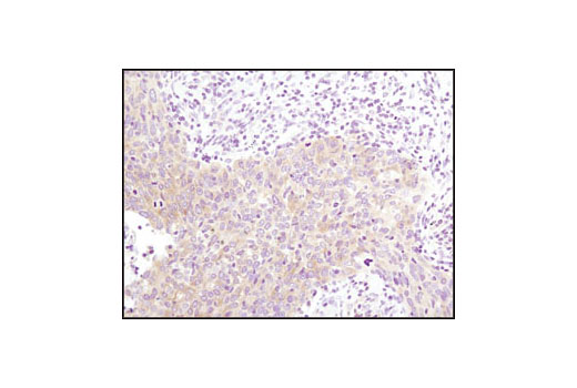 Immunohistochemistry Image 1: Glycogen Synthase (15B1) Rabbit mAb