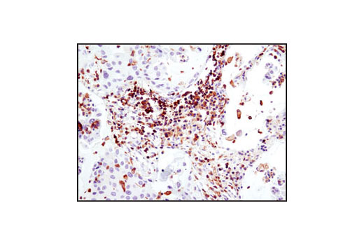 Immunohistochemistry Image 1: HS1 (D83A8) XP® Rabbit mAb
