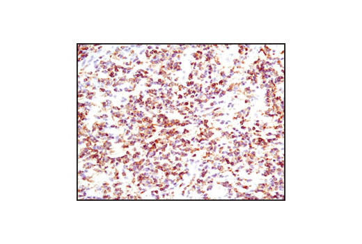 Immunohistochemistry Image 2: HS1 (D83A8) XP® Rabbit mAb