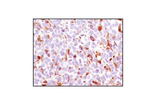Immunohistochemistry Image 2: HS1 (D5A9) XP® Rabbit mAb