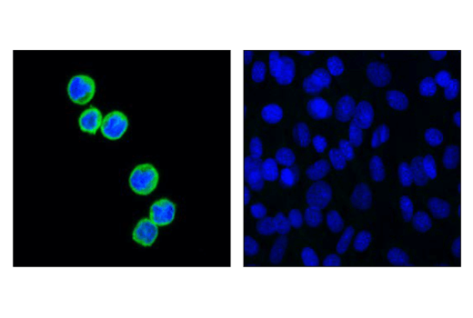  Image 35: Tau Mouse Model Neuronal Viability IF Antibody Sampler Kit