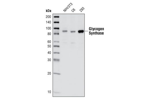 Western Blotting Image 1: Glycogen Synthase Antibody