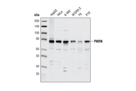 Western Blotting Image 1: PARN (A42) Antibody