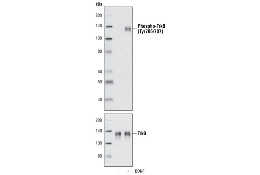  Image 1: Human Brain-Derived Neurotrophic Factor (BDNF) Recombinant Protein