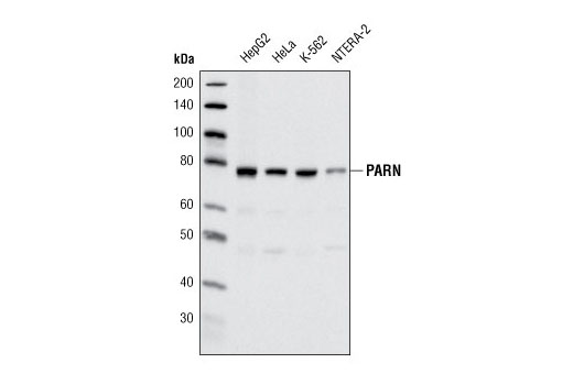 Western Blotting Image 1: PARN (P620) Antibody