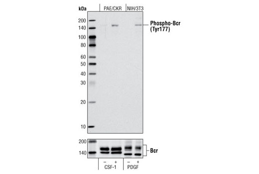 Western Blotting Image 2: Phospho-Bcr (Tyr177) Antibody
