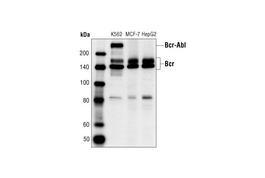 Western Blotting Image 1: Bcr Antibody