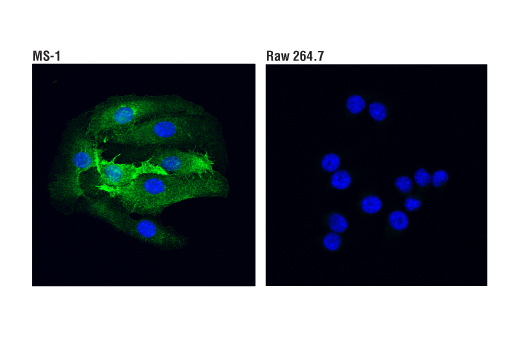 Immunofluorescence Image 3: VCAM-1 (D8U5V) Rabbit mAb