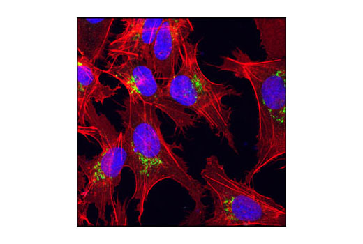 Immunofluorescence Image 1: AFP (3H8) Mouse mAb