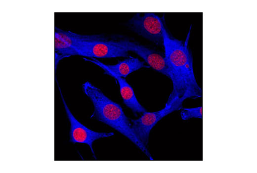 Immunofluorescence Image 1: GAPDH (14C10) Rabbit mAb (Alexa Fluor® 647 Conjugate)