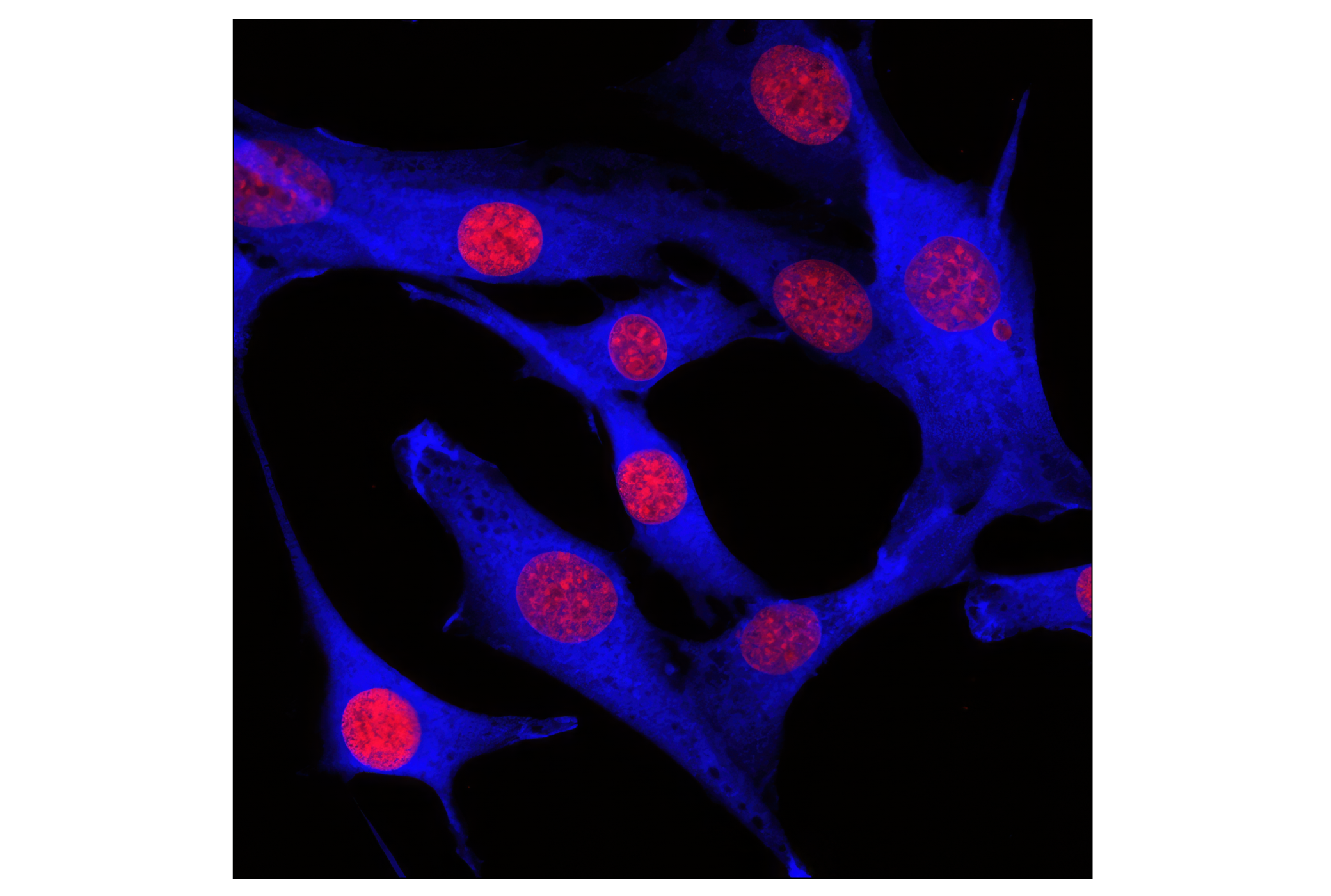 Immunofluorescence Image 1: GAPDH (14C10) Rabbit mAb (Alexa Fluor® 647 Conjugate)