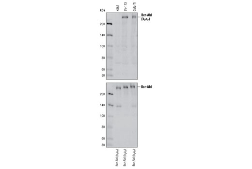 Western Blotting Image 1: Bcr-Abl (b2a2 Junction Specific) (L99H4) Mouse mAb