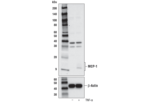  Image 14: Senescence Associated Secretory Phenotype (SASP) Antibody Sampler Kit