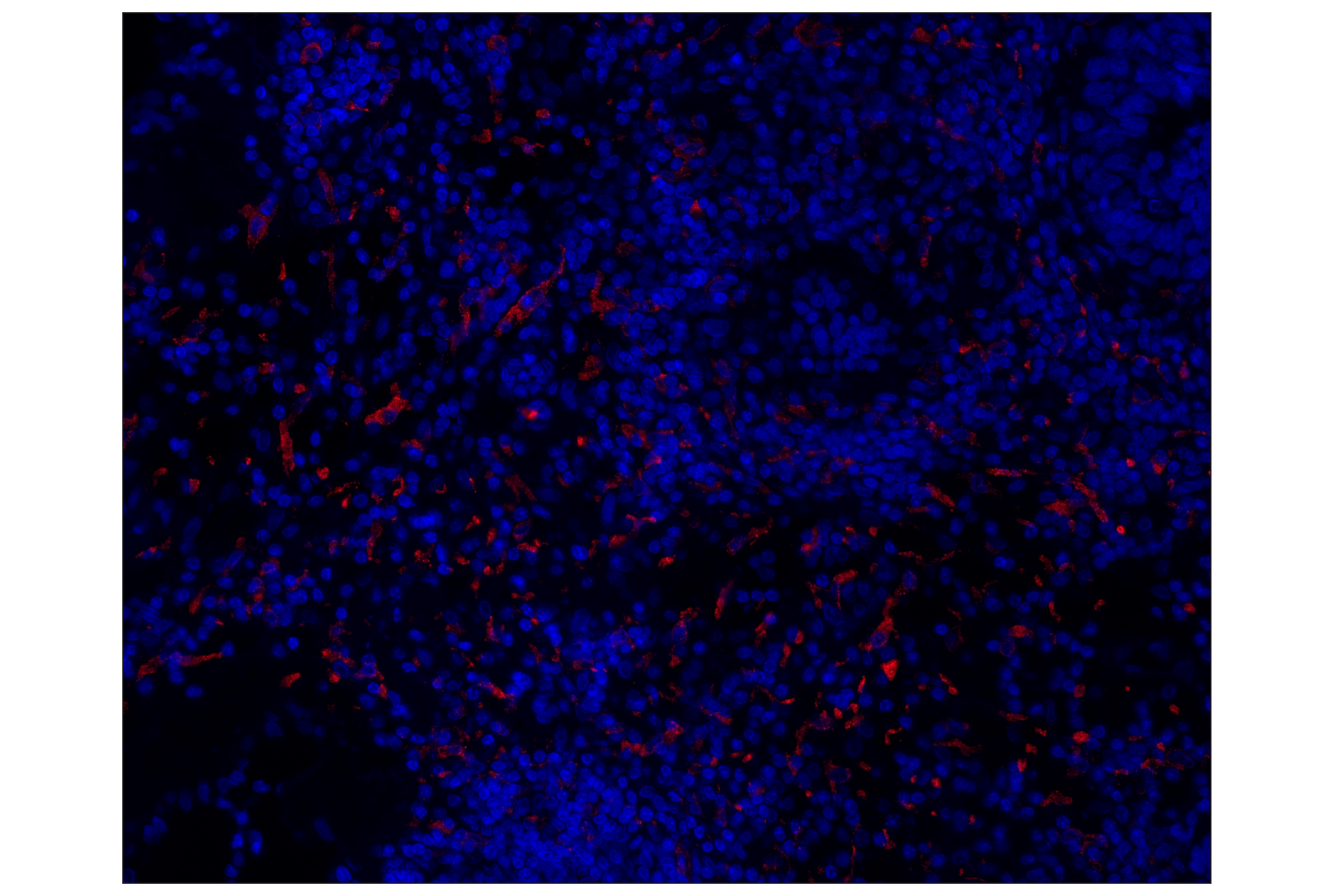 Immunohistochemistry Image 1: CD163 (D6U1J) Rabbit mAb (Alexa Fluor® 647 Conjugate)