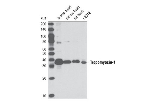 Western Blotting Image 1: Tropomyosin-1 (D12H4) Rabbit mAb