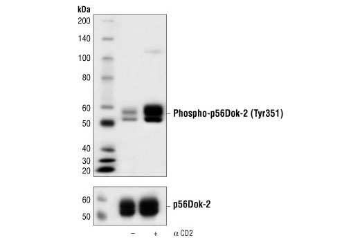 Western Blotting Image 1: Phospho-p56Dok-2 (Tyr351) Antibody