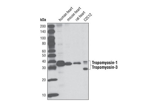 Western Blotting Image 1: Tropomyosin-1/3 (D17B8) Rabbit mAb