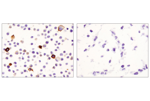 Immunohistochemistry Image 6: CD11c (D1V9Y) Rabbit mAb (BSA and Azide Free)