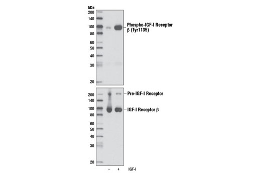 Western Blotting Image 1: Phospho-IGF-I Receptor β (Tyr1135) (DA7A8) Rabbit mAb