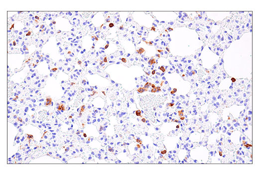 Immunohistochemistry Image 4: NK1.1/CD161 (E6Y9G) Rabbit mAb