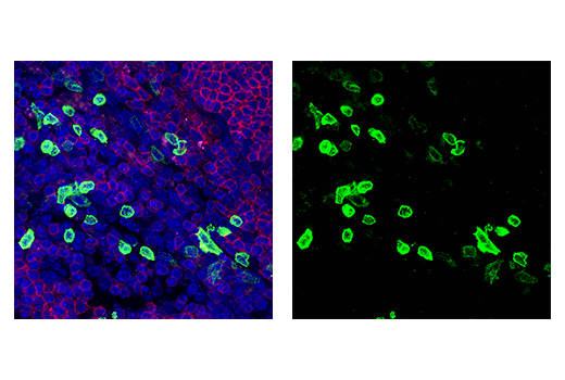 Immunofluorescence Image 1: NK1.1/CD161 (E6Y9G) Rabbit mAb