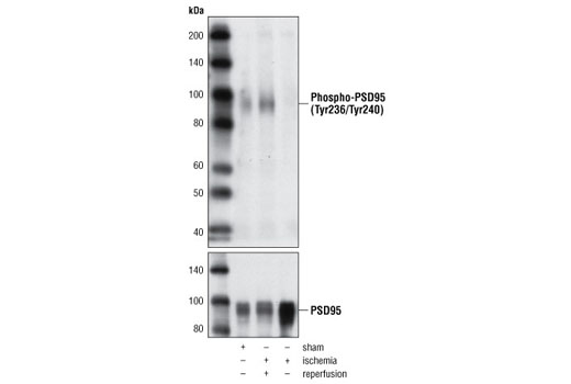 Western Blotting Image 1: Phospho-PSD95 (Tyr236/Tyr240) Antibody