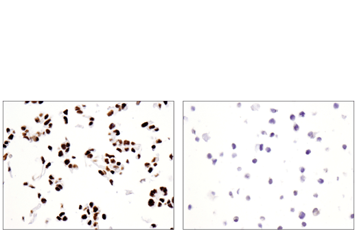 Immunohistochemistry Image 2: SATB2 (E8R8H) Rabbit mAb