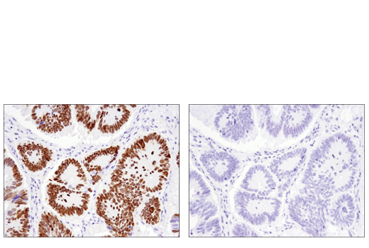 Immunohistochemistry Image 3: SATB2 (E8R8H) Rabbit mAb