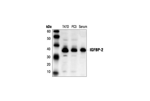Western Blotting Image 1: IGFBP2 Antibody