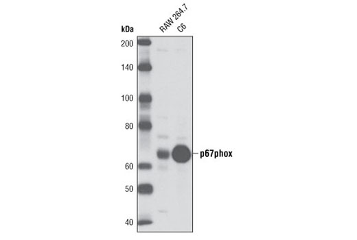 Western Blotting Image 1: p67phox Antibody