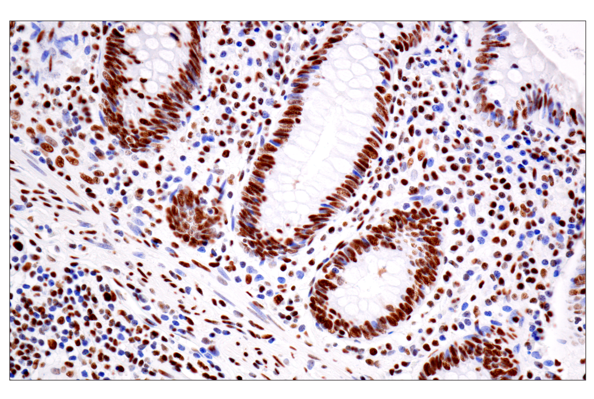 Immunohistochemistry Image 6: ILF3 (E5H6F) Rabbit mAb