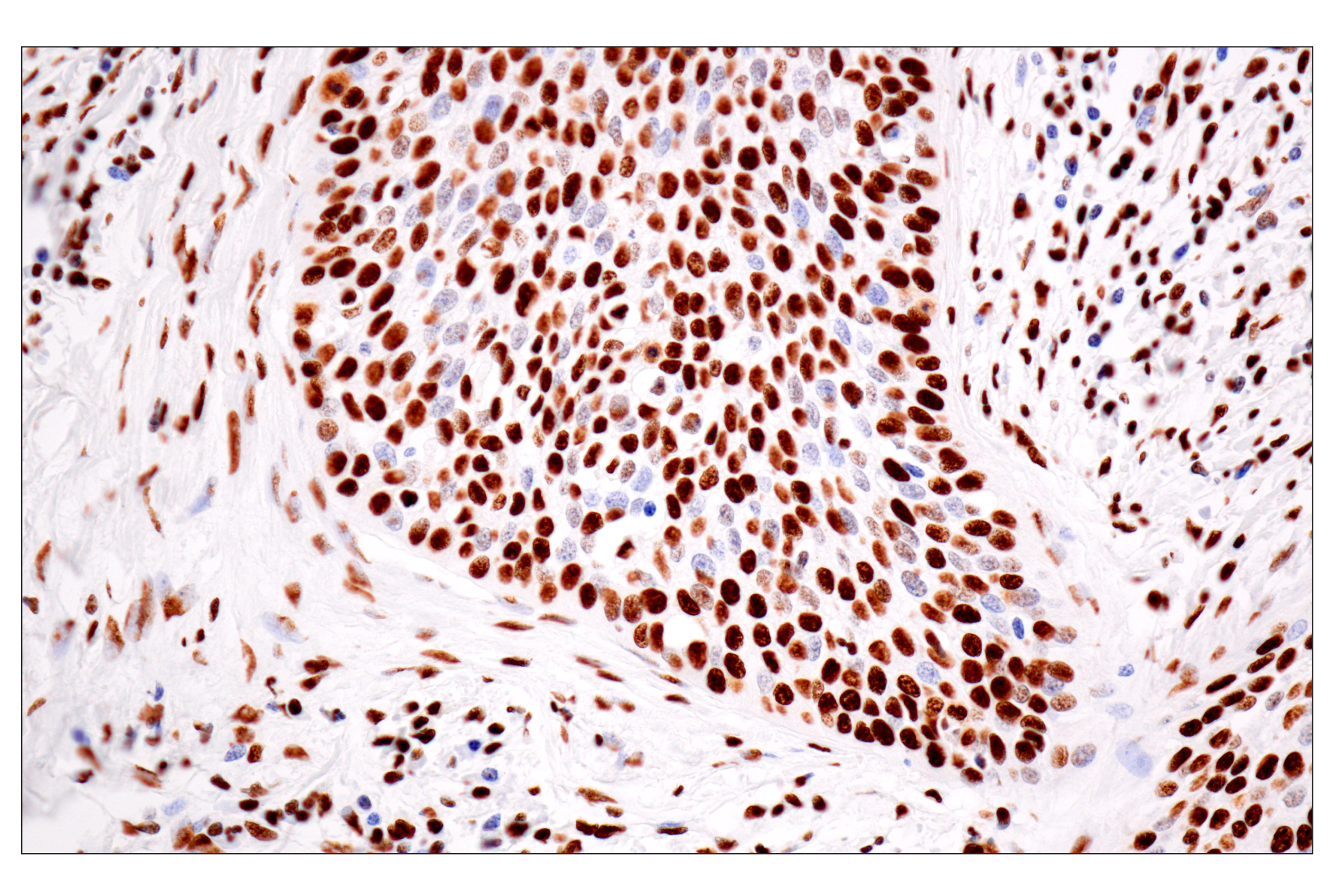 Immunohistochemistry Image 5: ILF3 (E5H6F) Rabbit mAb