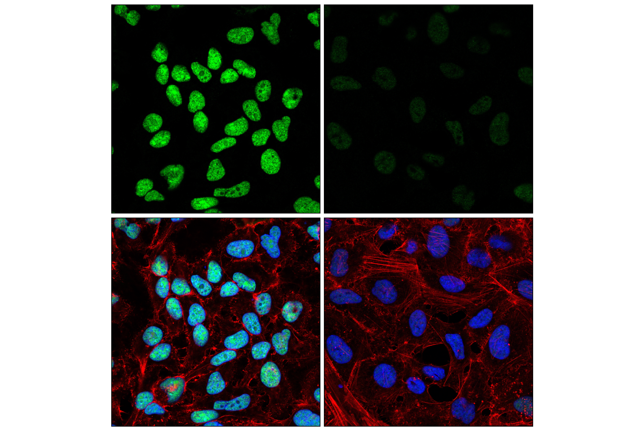 Immunofluorescence Image 1: ILF3 (E5H6F) Rabbit mAb