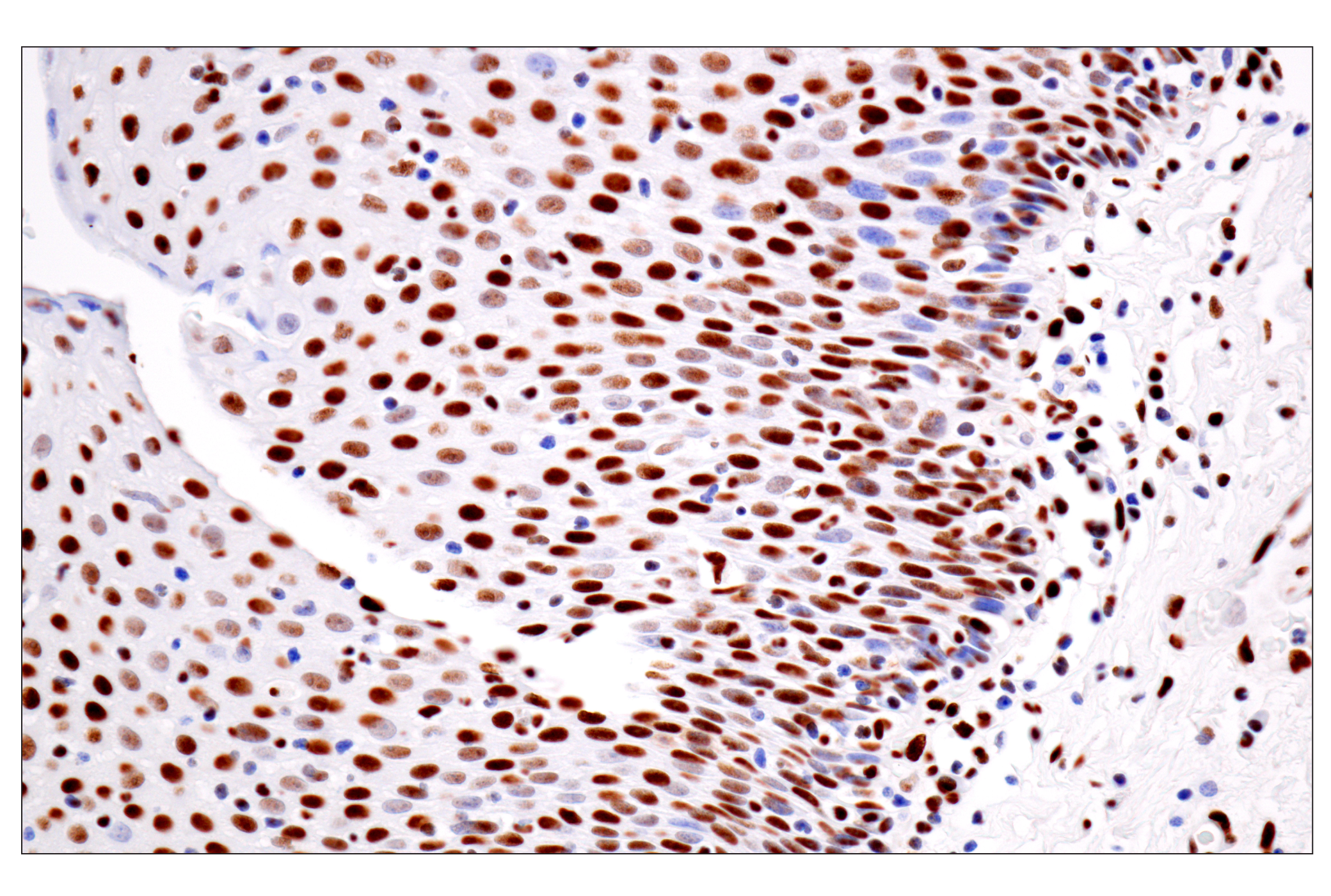 Immunohistochemistry Image 8: ILF3 (E5H6F) Rabbit mAb