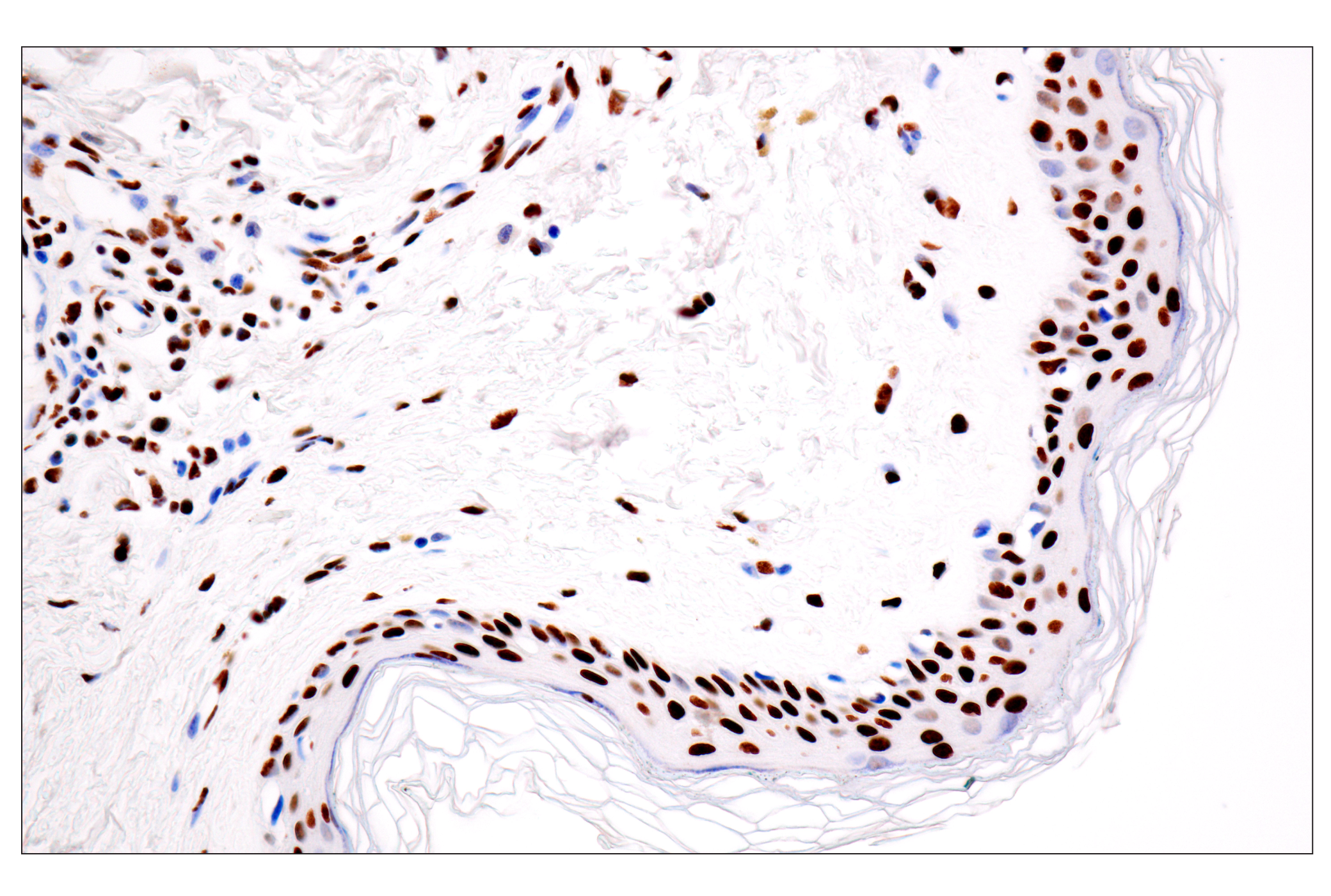 Immunohistochemistry Image 7: ILF3 (E5H6F) Rabbit mAb