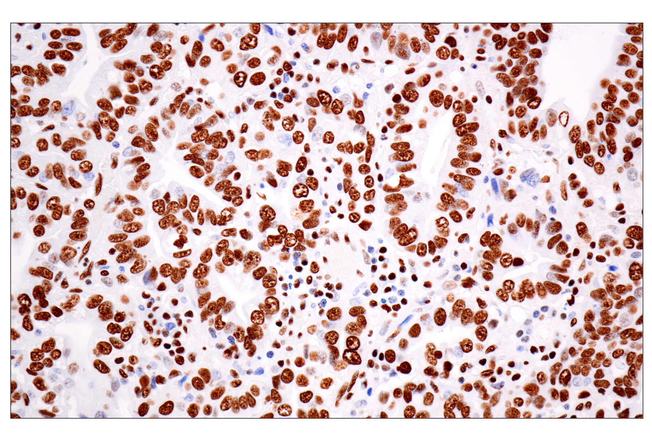 Immunohistochemistry Image 1: ILF3 (E5H6F) Rabbit mAb