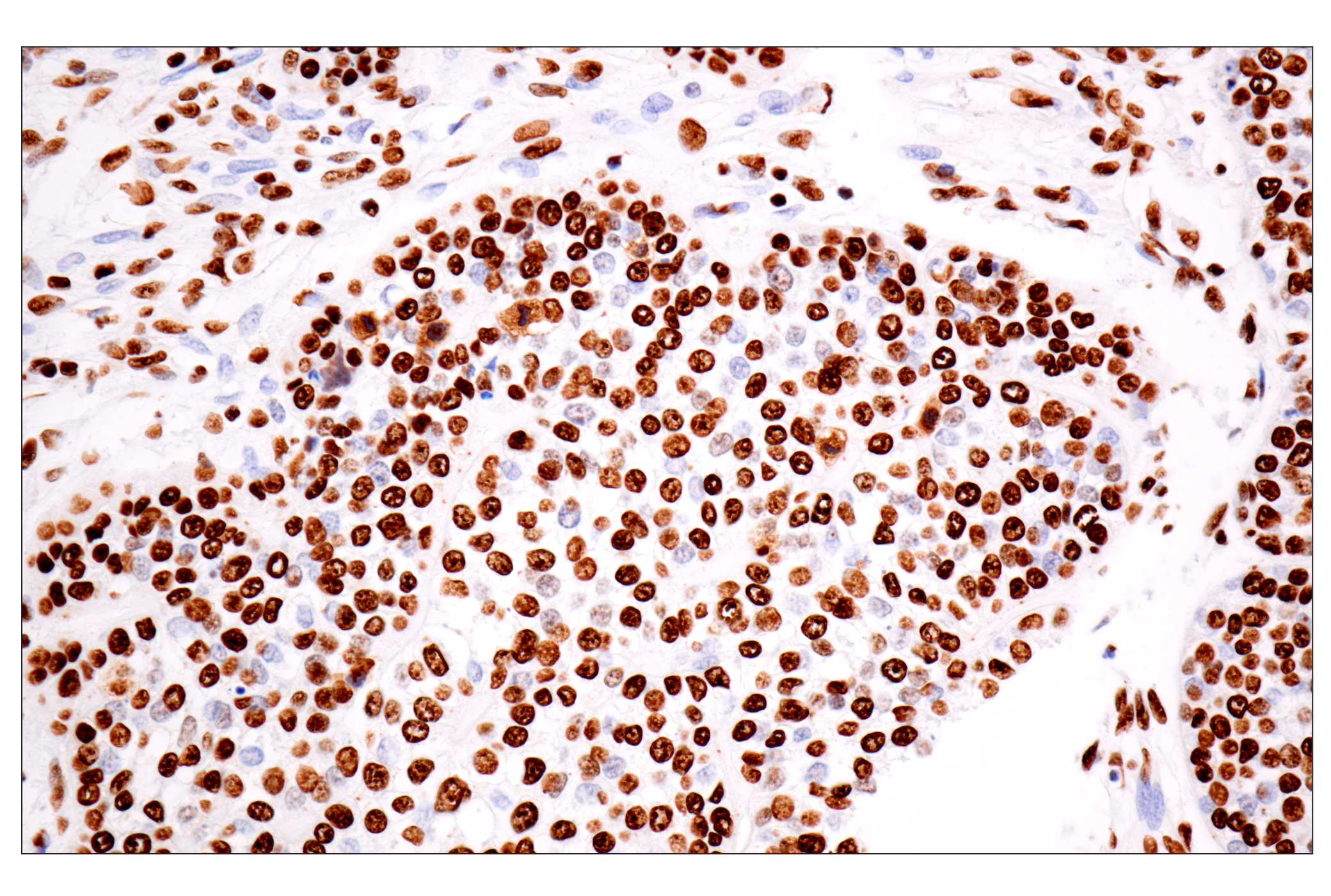 Immunohistochemistry Image 4: ILF3 (E5H6F) Rabbit mAb
