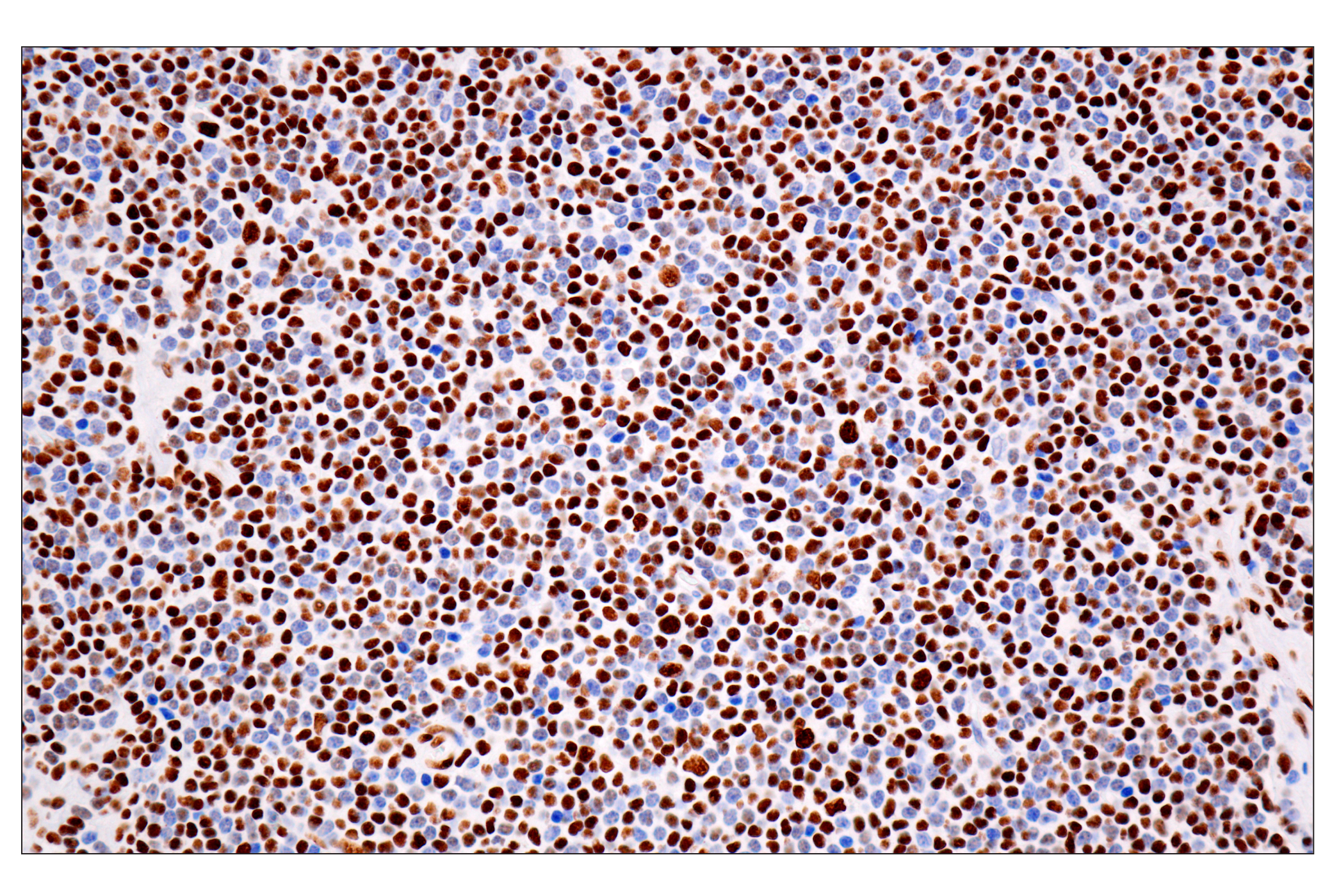 Immunohistochemistry Image 3: ILF3 (E5H6F) Rabbit mAb