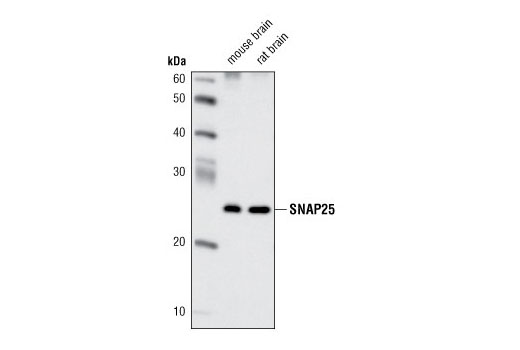Western Blotting Image 1: SNAP25 (D110) Antibody