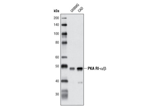 Western Blotting Image 1: PKA RI-α/β Antibody