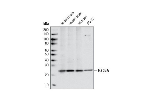 Western Blotting Image 1: Rab3A Antibody