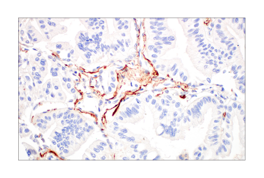 Immunohistochemistry Image 6: ApoE4 (E5M4L) Rabbit mAb