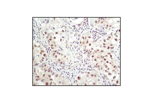 Immunohistochemistry Image 2: Ubiquitin Antibody