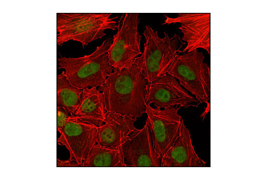 Immunofluorescence Image 1: PHF20 (D96F6) XP® Rabbit mAb