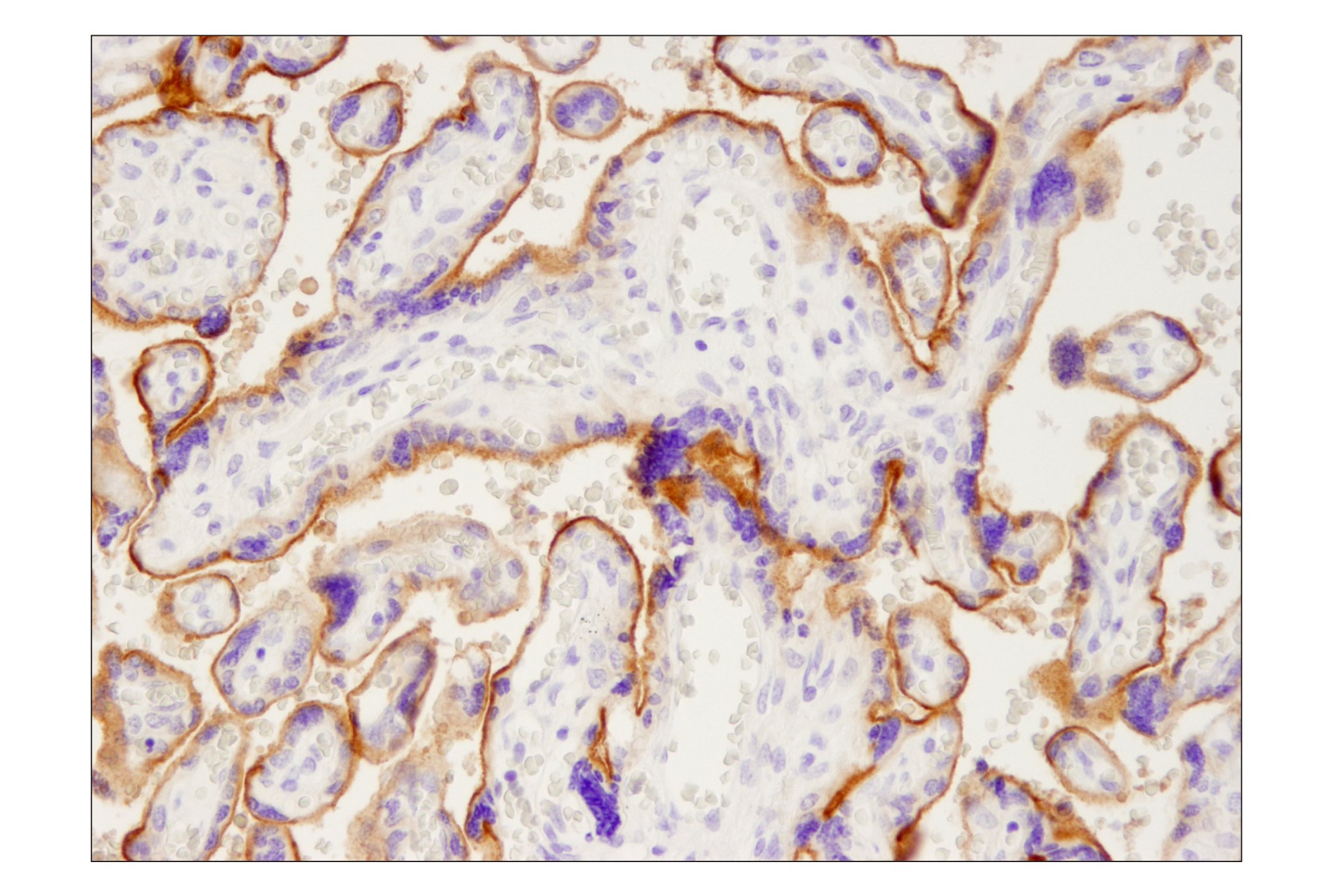 Immunohistochemistry Image 3: PD-L1 (405.9A11) Mouse mAb (BSA and Azide Free)