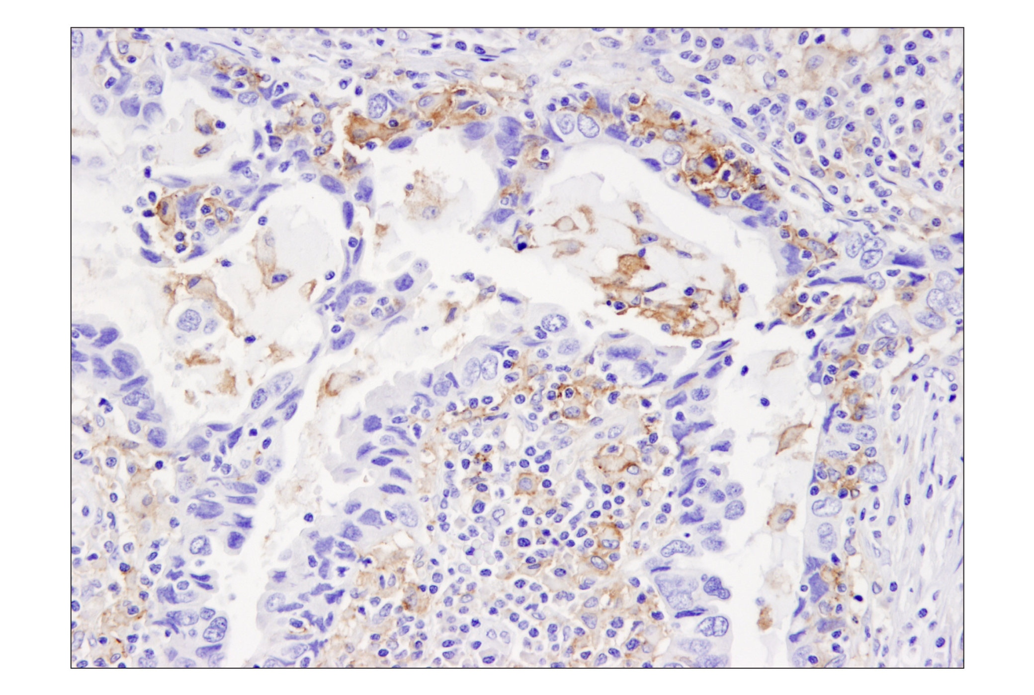 Immunohistochemistry Image 4: PD-L1 (405.9A11) Mouse mAb (BSA and Azide Free)