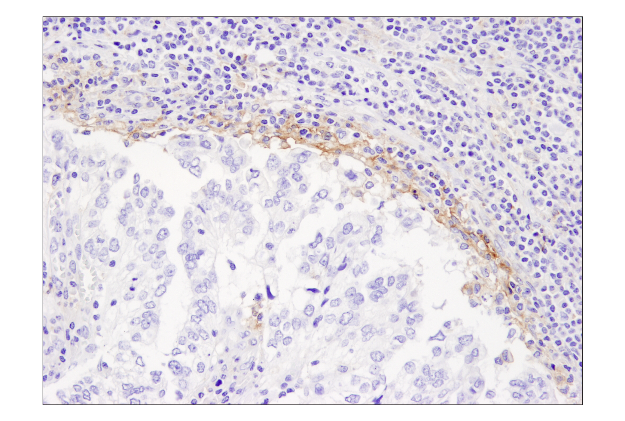 Immunohistochemistry Image 5: PD-L1 (405.9A11) Mouse mAb (BSA and Azide Free)