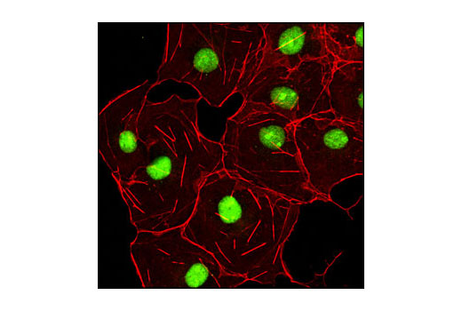 Immunofluorescence Image 1: HMGB1 Antibody