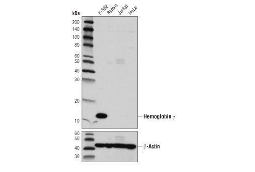 Western Blotting Image 1: Hemoglobin γ (D4K7X) Rabbit mAb