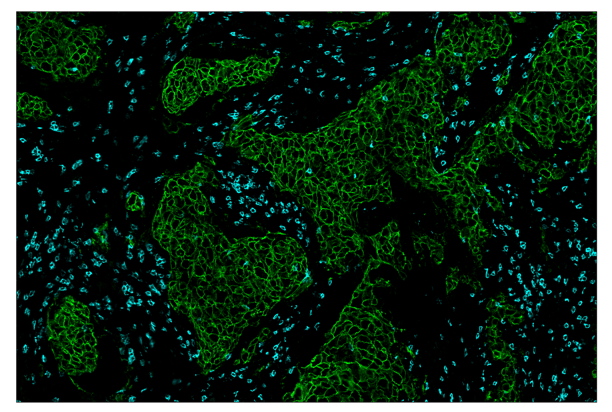 Immunohistochemistry Image 7: HER2/ErbB2 (D8F12) & CO-0059-488 SignalStar™ Oligo-Antibody Pair